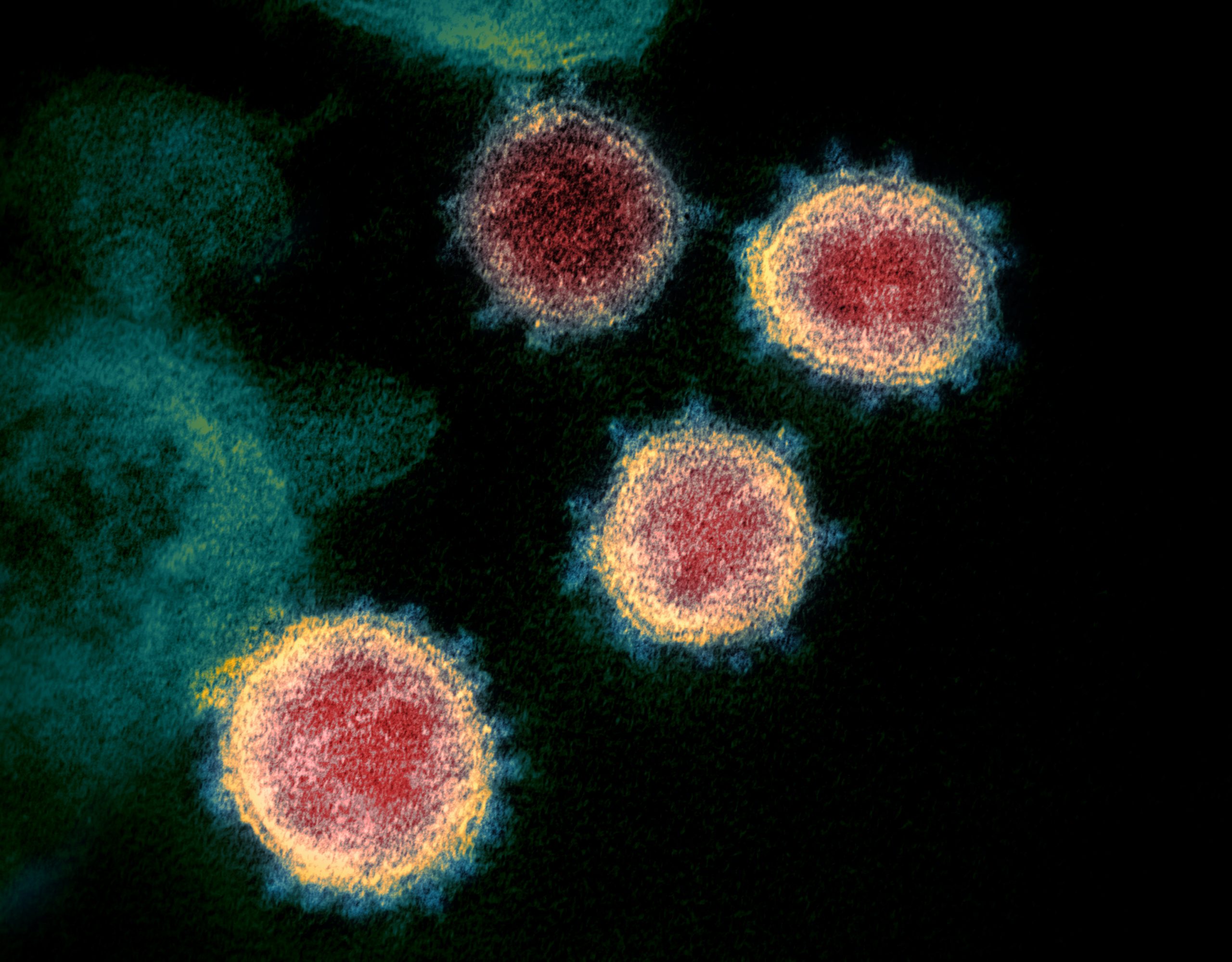 coronavirus