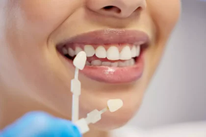 fatete-dentare-zirconiu