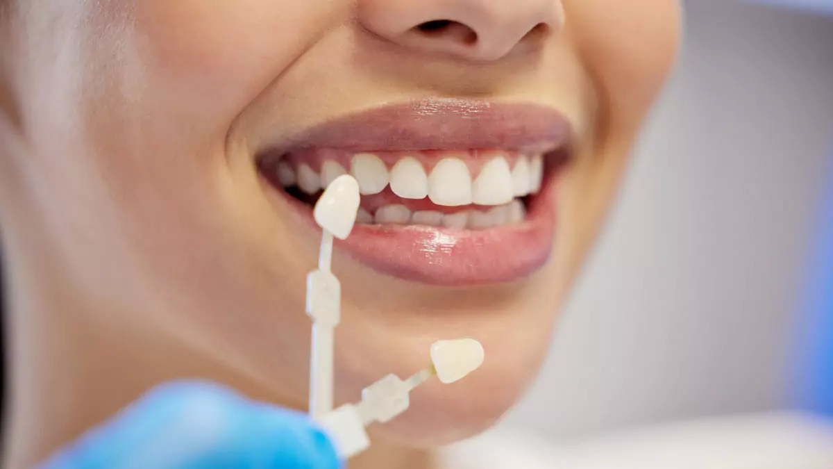 fatete-dentare-zirconiu