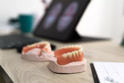 dantura-all-on-4-sau-all-on-6