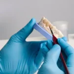 un-zmbet-de-poveste-sau-o-urgen-dentar-cnd-este-necesar-coroana-dentar