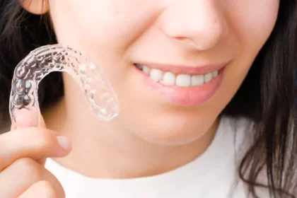 aparat-dentar-invizibil