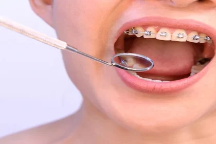 pretul-unui-aparat-fb-event-cover