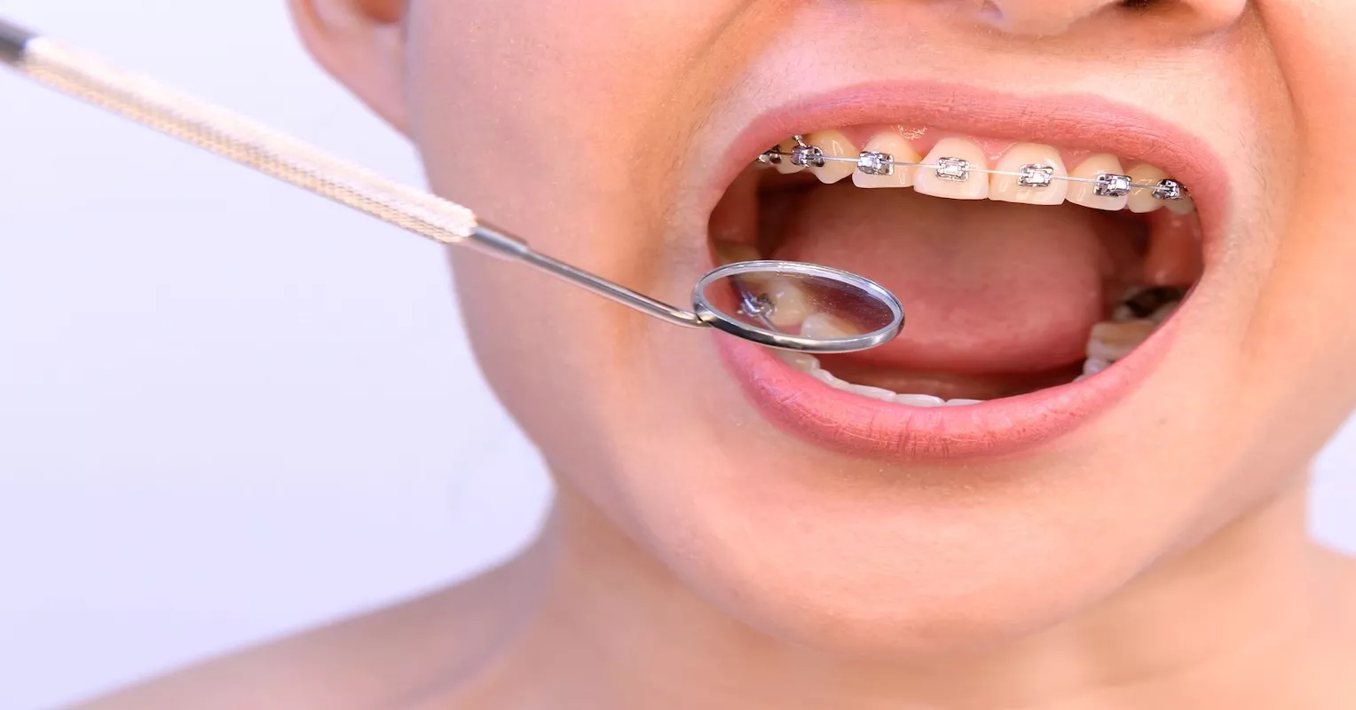 pretul-unui-aparat-fb-event-cover