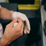 cnd-se-recomand-proceduri-miniminvazive-pentru-hemoroizi