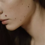 investigatii-si-tratamente-dermatologice