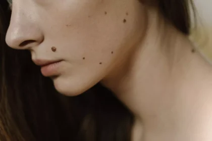 investigatii-si-tratamente-dermatologice