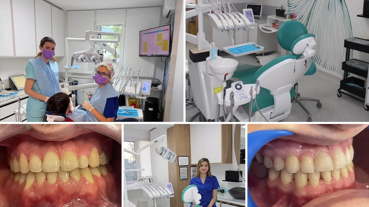 cnd-este-necesar-tratamentul-parodontozei-cu-laser-i-ce-avantaje-are-fa-de-metodele-clasice-explic-specialitii-dental-science-din-sectorul-6-bucureti-6abc2039dd2bc