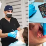 cat rezista un implant dentar