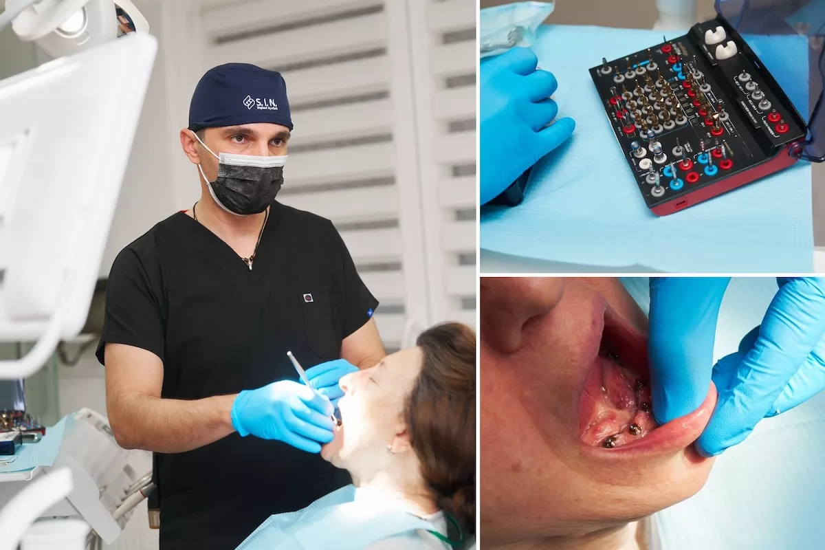 cat rezista un implant dentar